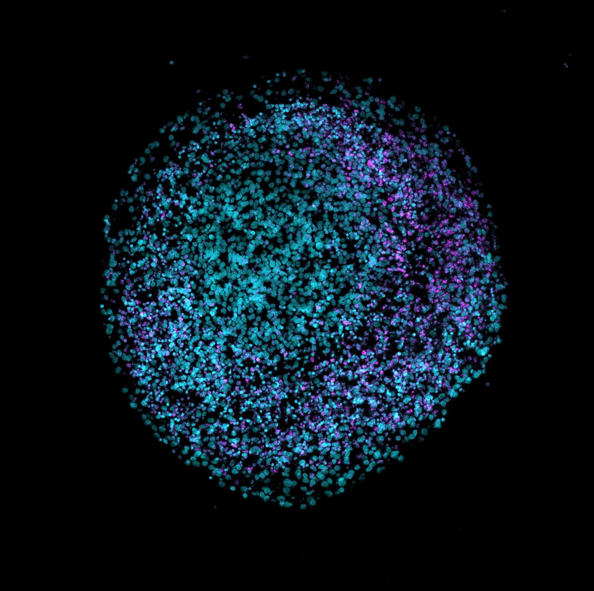 Conceptual image of neural tissue connected to electronics